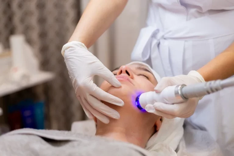 Everything You Need to Know About Cryofacials